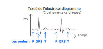 Tracé ECG - Cycle cardiaque